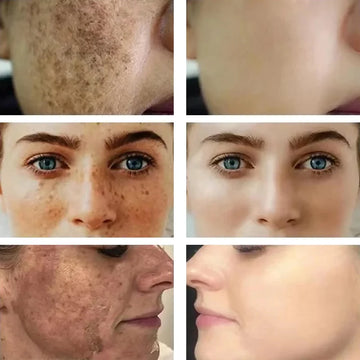 Unleash Your Skin's Radiance and Confidence!