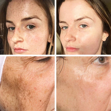 Unleash Your Skin's Radiance and Confidence!